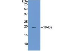 Detection of Recombinant PROCR, Rat using Polyclonal Antibody to Endothelial protein C receptor (EPCR) (PROCR antibody  (AA 59-217))