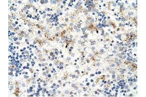 MOV10 antibody was used for immunohistochemistry at a concentration of 4-8 ug/ml to stain Hepatocytes (arrows) in Human Liver. (MOV10 antibody)