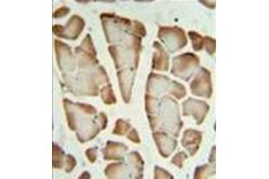 Formalin fixed, paraffin embedded skeletal muscle stained with Syntaxin 1A / STX1A Antibody (N-term) followed by peroxidase conjugation of the secondary antibody and DAB staining. (STX1A antibody  (N-Term))