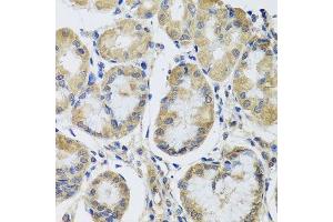 Immunohistochemistry of paraffin-embedded human stomach using MRPL1 antibody. (MRPL1 antibody  (AA 51-325))
