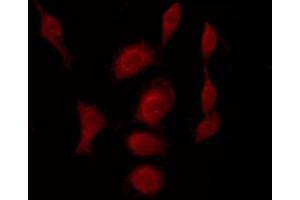 ABIN6267447 staining A2780 by IF/ICC. (CDK1 antibody  (pThr14))