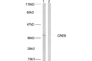 Western blot analysis of extracts from HeLa cells treated with UV, using CREB (Ab-129/133) antibody (#B7053). (CREB1 antibody  (Ser129, Ser133))