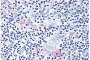 Anti-ROR Gamma antibody  ABIN1049298 IHC staining of human thymus.