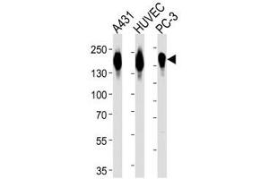 Western blot analysis of lysate from A431, HUVEC, PC3 cell line (left to right) using anti-EGFR antibody diluted at 1:1000 for each lane. (EGFR antibody  (AA 1004-1033))