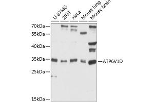 Western blot analysis of extracts of various cell lines, using V1D antibody (ABIN6127397, ABIN6137348, ABIN6137349 and ABIN6216761) at 1:3000 dilution. (ATP6V1D antibody  (AA 1-247))