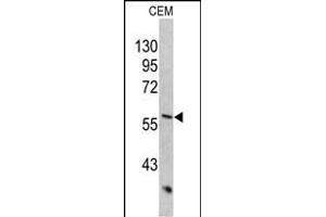 Western blot analysis of KRT10 antibody (Center) (ABIN390659 and ABIN2840954) in CEM cell line lysates (35 μg/lane). (Keratin 10 antibody  (AA 318-346))