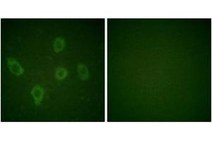 Immunofluorescence analysis of HuvEc cells, using Caspase 9 (Ab-125) Antibody. (Caspase 9 antibody  (AA 91-140))