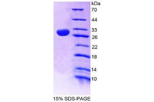 SDS-PAGE (SDS) image for Nitric Oxide Synthase 1 (Neuronal) Adaptor Protein (NOS1AP) (AA 285-506) protein (His tag) (ABIN1980719)