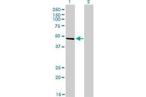 Western Blot analysis of CREB3 expression in transfected 293T cell line by CREB3 monoclonal antibody (M01), clone 3H5. (CREB3 antibody  (AA 273-371))