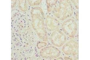 Immunohistochemistry of paraffin-embedded human kidney tissue using ABIN7156314 at dilution of 1:100 (INPP5K antibody  (AA 149-448))