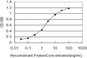 Detection limit for recombinant GST tagged STAG1 is approximately 0. (Stromal Antigen 1 antibody  (AA 1112-1221))