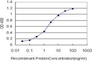 Detection limit for recombinant GST tagged STAG1 is approximately 0. (Stromal Antigen 1 antibody  (AA 1112-1221))