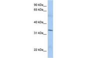 Image no. 1 for anti-Mitochondrial Ribosomal Protein L15 (MRPL15) (AA 35-84) antibody (ABIN6743415) (MRPL15 antibody  (AA 35-84))