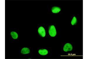 Immunofluorescence of monoclonal antibody to ZNF207 on HeLa cell. (ZNF207 antibody  (AA 1-110))
