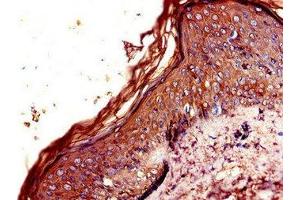 Immunohistochemistry of paraffin-embedded human skin tissue using ABIN7146648 at dilution of 1:100 (CNR2 antibody  (AA 305-360))