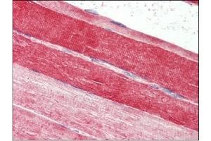 Skeletal muscle, Human: Formalin-Fixed, Paraffin-Embedded (FFPE) (FABP7 antibody  (C-Term))