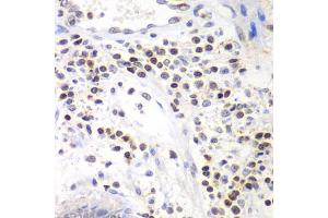 Immunohistochemistry of paraffin-embedded human colon using SMARCA4 antibody. (SMARCA4 antibody)