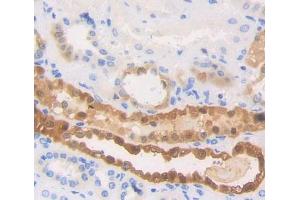 Used in DAB staining on fromalin fixed paraffin- embedded Kidney tissue (HSPA6 antibody  (AA 1-387))