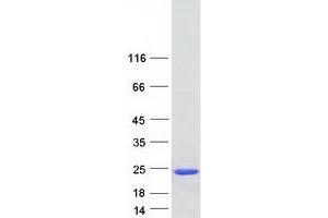 Validation with Western Blot