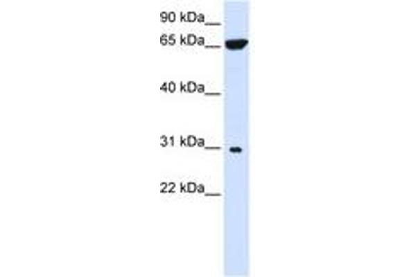 PTPLAD2 anticorps  (AA 72-121)