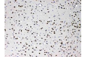 PSMA3 was detected in paraffin-embedded sections of mouse brain tissues using rabbit anti- PSMA3 Antigen Affinity purified polyclonal antibody (Catalog # ) at 1 µg/mL.