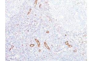 Formalin-fixed, paraffin-embedded human tonsil stained with VEGF antibody (VEGF/1063).