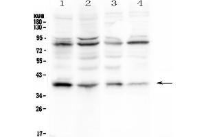 Western Blotting (WB) image for anti-Nuclear Factor of kappa Light Polypeptide Gene Enhancer in B-Cells Inhibitor, alpha (NFKBIA) (AA 3-112) antibody (ABIN3043889)
