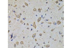 Immunohistochemistry of paraffin-embedded Mouse brain using EIF4A2 Polyclonal Antibody at dilution of 1:100 (40x lens). (EIF4A2 antibody)