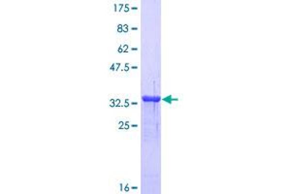 MT1A Protein (AA 1-61) (GST tag)
