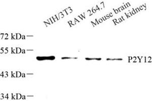 Western blot analysis of P2Y12 (ABIN7075321) at dilution of 1: 250 (P2RY12 antibody)