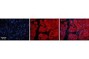 Rabbit Anti-Tnks Antibody  Catalog Number: ARP33978_P050 Formalin Fixed Paraffin Embedded Tissue: Human Adult heart  Observed Staining: Cytoplasmic Primary Antibody Concentration: 1:600 Secondary Antibody: Donkey anti-Rabbit-Cy2/3 Secondary Antibody Concentration: 1:200 Magnification: 20X Exposure Time: 0.