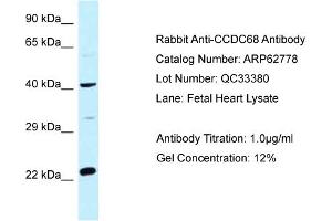 Western Blotting (WB) image for anti-Coiled-Coil Domain Containing 68 (CCDC68) (Middle Region) antibody (ABIN2774351) (CCDC68 antibody  (Middle Region))