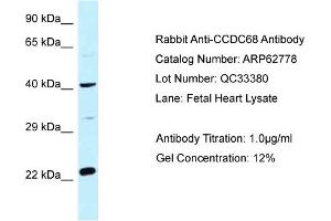 Western Blotting (WB) image for anti-Coiled-Coil Domain Containing 68 (CCDC68) (Middle Region) antibody (ABIN2774351)