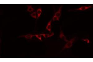ABIN6274596 staining HepG2 by IF/ICC. (CDH15 antibody  (N-Term))