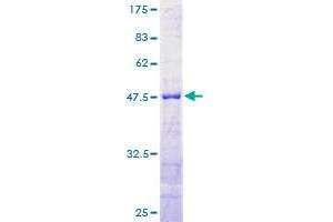 Reticulon 1 Protein (RTN1) (AA 1-208) (GST tag)