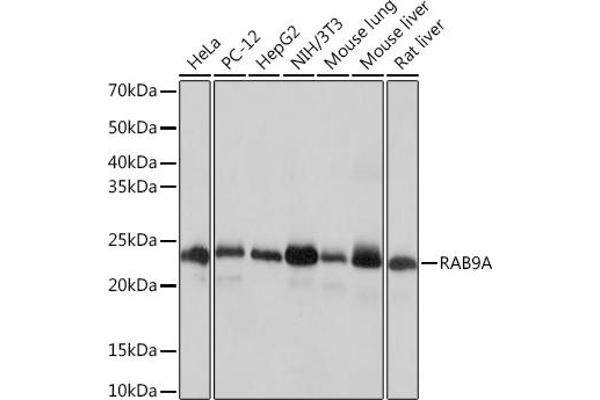 RAB9A antibody