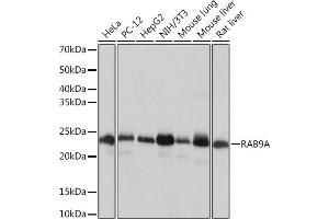 Western blot analysis of extracts of various cell lines, using RA Rabbit mAb (ABIN7269817) at 1:1000 dilution. (RAB9A antibody)