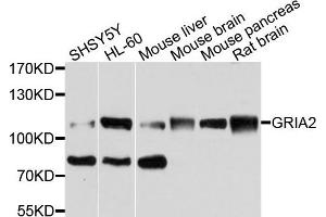 Western blot analysis of extracts of various cells, using MET antibody. (c-MET antibody)
