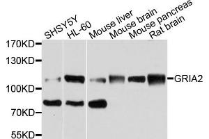 Western blot analysis of extracts of various cells, using MET antibody.