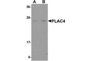 Western blot analysis of PLAC4 in human placenta tissue lysate with PLAC4 antibody at (A) 1 and (B) 2 μg/ml. (PLAC4 antibody  (Center))