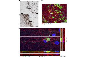 Lipocalin 2 (LCN2) expression in the active rim of multiple sclerosis (MS) lesions. (Lipocalin 2 antibody  (AA 21-200))