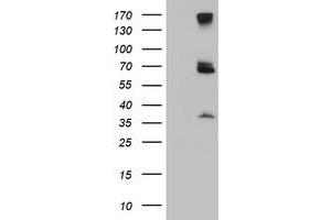 Western Blotting (WB) image for anti-Proteasome (Prosome, Macropain) 26S Subunit, Non-ATPase, 3 (PSMD3) antibody (ABIN1499980) (PSMD3 antibody)