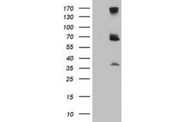 PSMD3 antibody