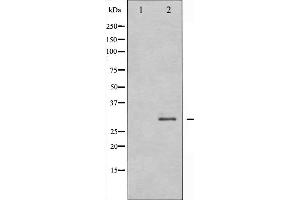 Western blot analysis of RFA2 expression in K562 whole cell lysates,The lane on the left is treated with the antigen-specific peptide. (RPA2 antibody  (N-Term))
