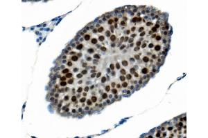 anti-Polypyrimidine Tract Binding Protein 2 (PTBP2) (AA 1-504) antibody