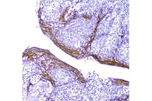 IHC analysis of Periplakin using anti-Periplakin antibody (ABIN5518787). (PPL antibody  (C-Term))