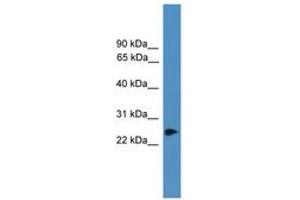 Image no. 1 for anti-Ring Finger Protein 114 (RNF114) (C-Term) antibody (ABIN6745403) (RNF114 antibody  (C-Term))