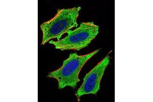 Immunofluorescence analysis of Hela cells using MLXIPL mouse mAb (green). (MLXIPL antibody  (AA 18-143))