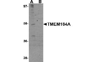 Western Blotting (WB) image for anti-Transmembrane Protein 184A (TMEM184A) (C-Term) antibody (ABIN1030750) (TMEM184A antibody  (C-Term))
