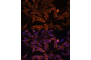 Immunofluorescence analysis of HeLa cells using CACYBP antibody  at dilution of 1:100. (CACYBP antibody  (AA 1-228))